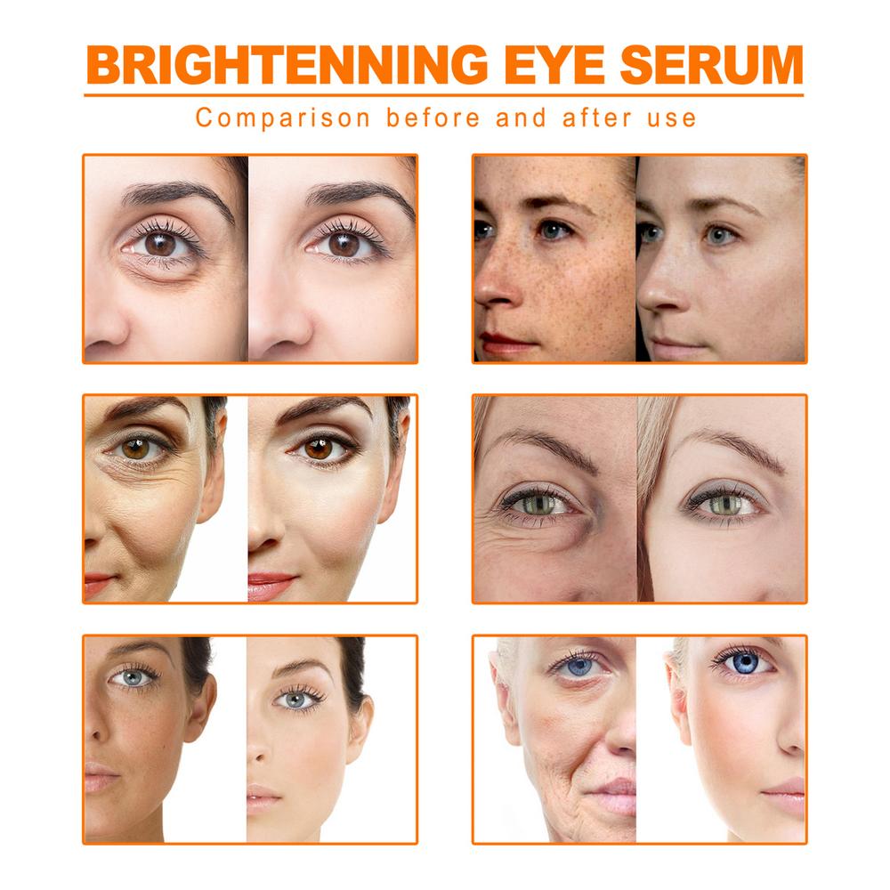 Turmeric Essential Oil 10ml