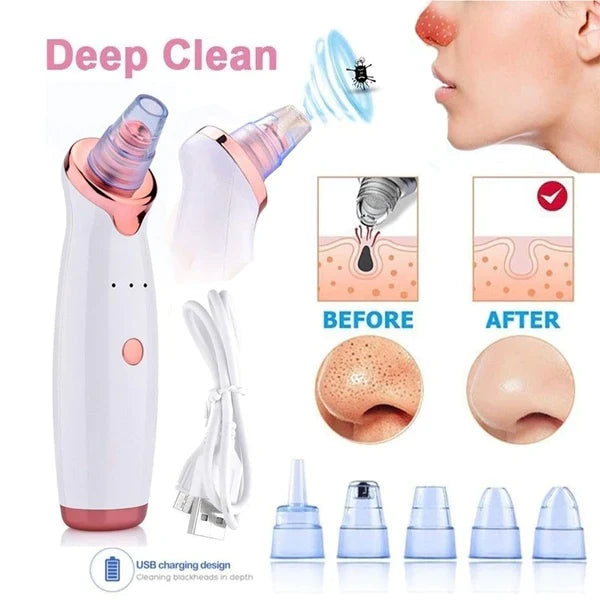 Electric USB Rechargeable Blackhead