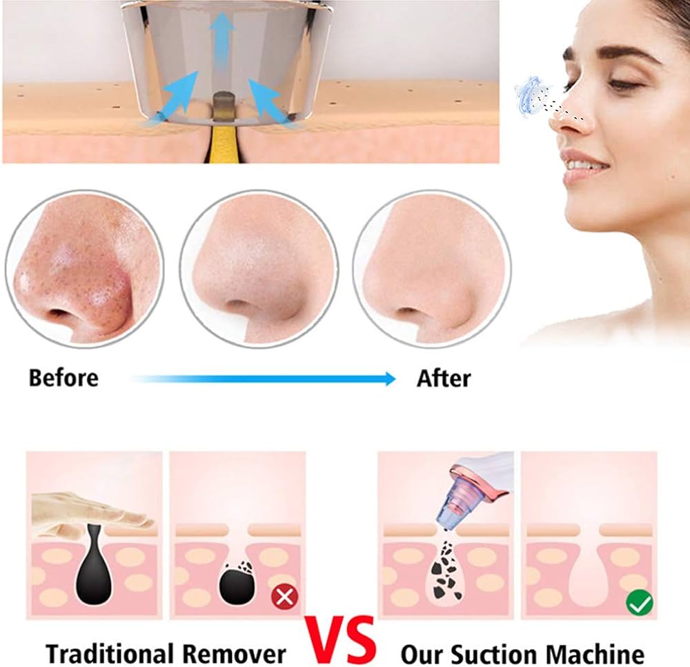 Electric USB Rechargeable Blackhead